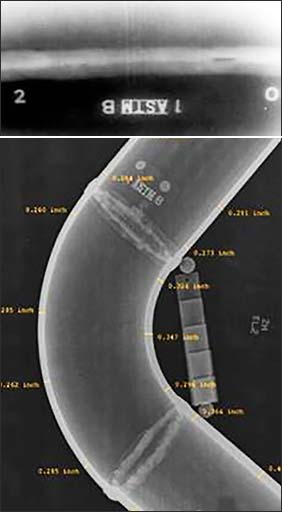 Computed Radiography